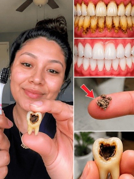 ¡Alerta Dental! ¿Tu Cepillo Está Destrozando Tus Dientes EN SECRETO? El Único Error que el 90% de los Mexicanos Comete Sin Saberlo