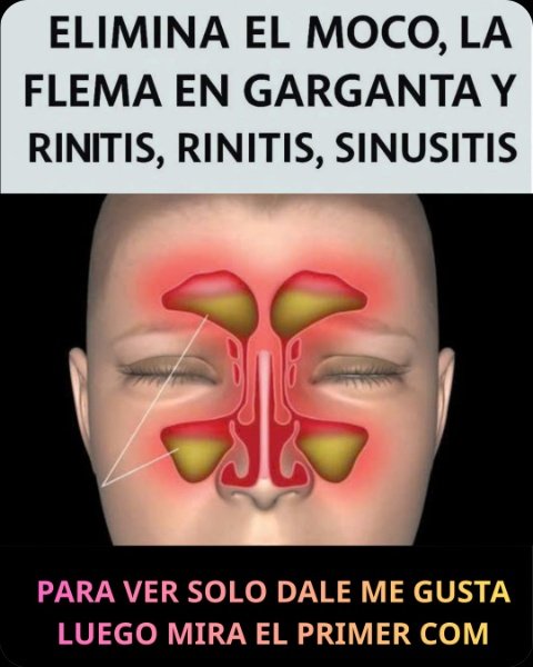 ¡Respira Libremente HOY! Los 7 Remedios Caseros Definitivos para Eliminar Moco, Flema y Rinitis al Instante