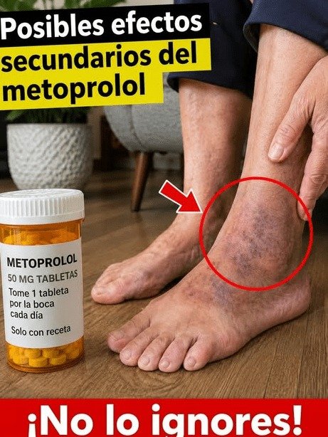 ¡Alerta en México! ¿Moretones, Cansancio Extremo y Pies Fríos? Lo que NADIE te dice sobre tu Metoprolol y DEBES saber AHORA