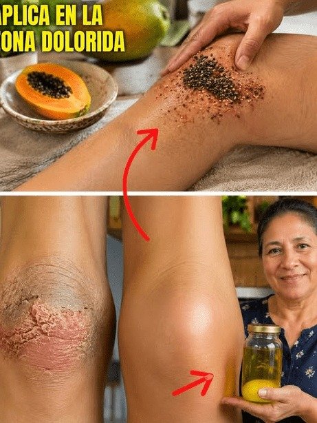 ¿Sufres de Dolor Articular? ¡No Hagas ESTO! Descubre el TRUCO ANCESTRAL que miles de abuelos usan en México para sentirse jóvenes OTRA VEZ