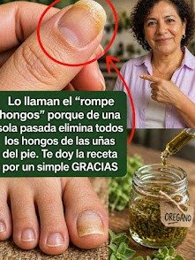 ¡El Secreto Viral de tu Cocina para Eliminar los Hongos de las Uñas en Tiempo Récord! (Nadie te lo había contado)