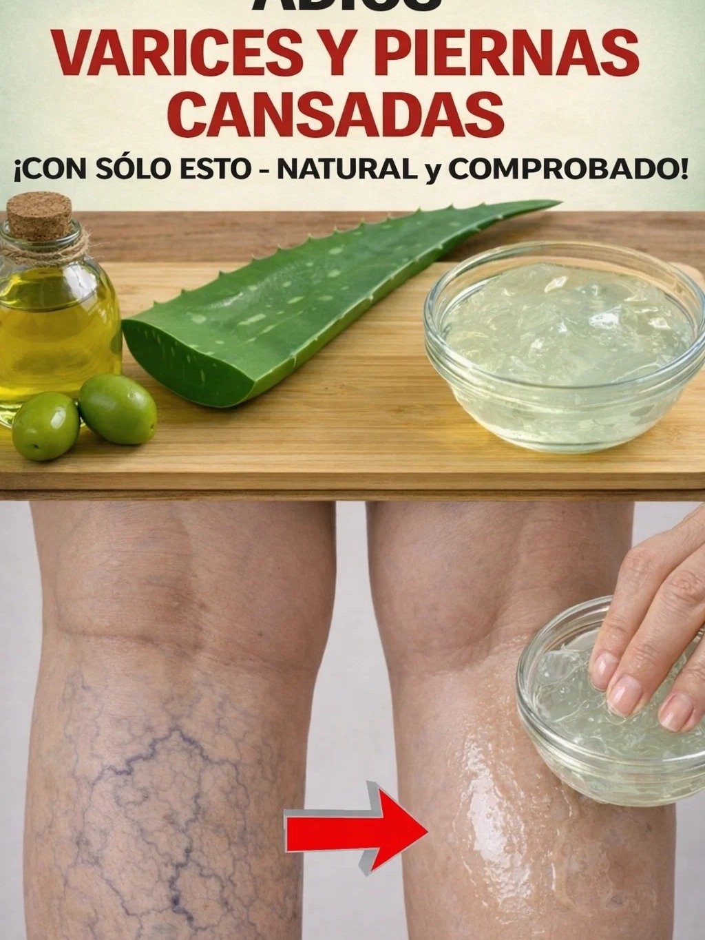 ¡Adiós Várices! El Remedio Secreto de tu Abuela con Aloe Vera y Limón que Transformará tus Piernas en Días