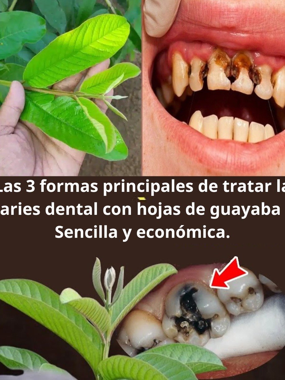 ¡Adiós Caries! 3 Secretos Naturales y Económicos con Hojas de Guayabo que Tu Dentista NO Te Ha Contado