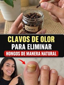 ¡Adiós Hongos en las Uñas! El SECRETO Ancestral con Clavos de Olor que DEBES Conocer AHORA