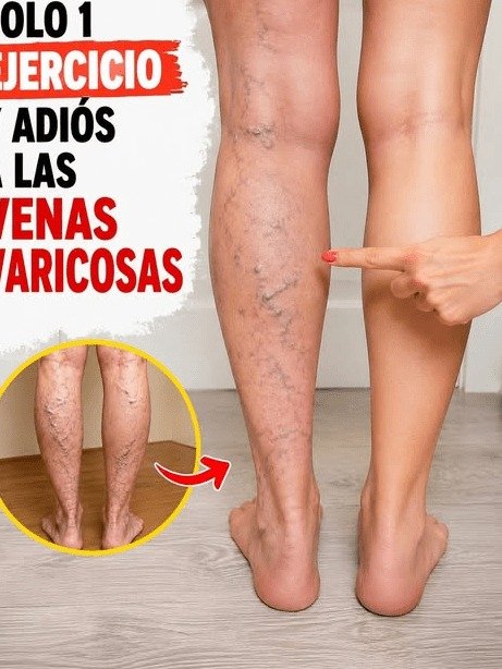 ¡Adiós Piernas Pesadas! El SECRETO de 5 Minutos que Millones en México Desconocen (y te Urge Probar HOY)