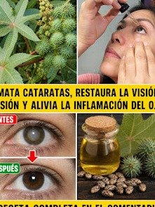 El Secreto Natural que Nadie Te Cuenta para FRENAR Cataratas y Desinflamar Tus Ojos: ¡Recupera Tu Visión Ya!