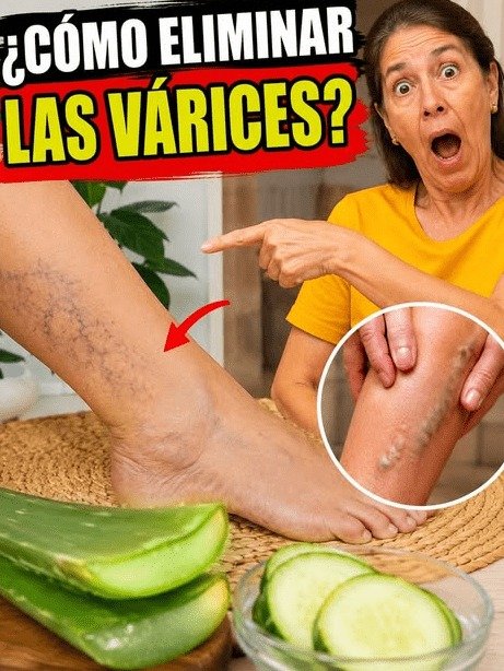 ¡Alerta! Si Sientes Piernas Pesadas y Venitas, Estás Cometiendo ESTE Error Nocturno (¡El 99% en México lo ignora!)