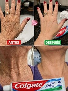 ¡El Secreto 'Antiedad' Viral que Borra Arrugas y Manchas de Tus Manos y Brazos! (Parecerá que te Hiciste Cirugía sin Bisturí)