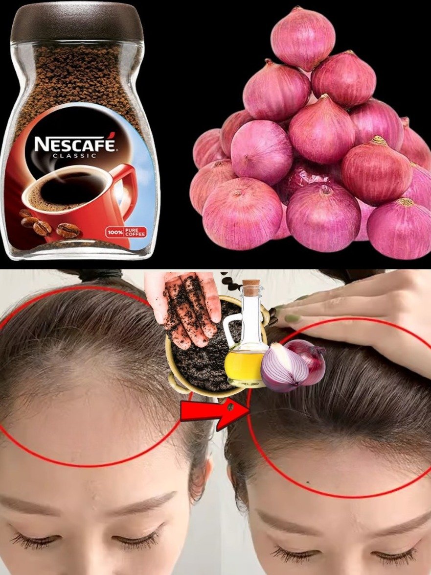 ¡El Truco Casero de Café, Ajo y Cebolla que Detendrá la Caída del Cabello y Lo Hará Crecer sin Parar (¡Resultados en Semanas!)