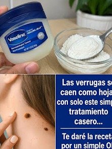 ¡Adiós Verrugas para Siempre! Descubre los 6 Secretos Caseros que Transformarán Tu Piel (¡Resultados Reales y Suaves!)