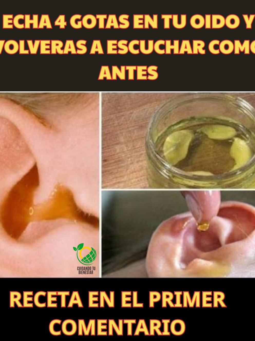 ¡Adiós al Dolor de Oído! Descubre 4 Remedios Naturales Secretos Que Debes Probar HOY Mismo