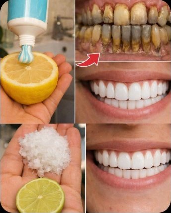 ¡El Truco de Cocina que Nadie Te Contó: Cómo la Cebolla Morada Encurtida Revoluciona Tus Platos Saludables!