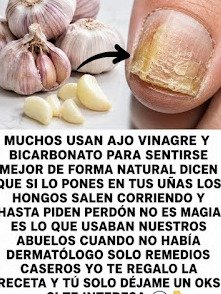 ¡El Secreto Viral de 2 Ingredientes Baratos para Eliminar los Hongos de tus Uñas y Recuperar su Belleza!