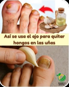 ¡El Remedio Casero que Nadie te Contó! Elimina los Hongos de Cabeza, Manos, Uñas y Pies para Siempre con Ajo