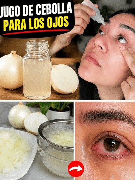 ¡ALERTA MUNDIAL! ¿Pones JUGO de CEBOLLA en tus OJOS? El PELIGRO VIRAL que MILLONES ignoran (y por qué DEBES parar AHORA)