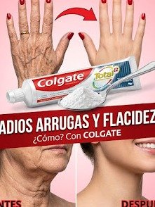 ¡Tu Cirujano Odiará Esto! La Receta Natural Que Borra Arrugas y Manchas de Manos y Brazos Sin Bisturí