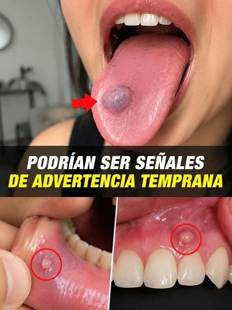 ¡ALERTA ROJA! ¿Bolita en tu Lengua o Encía? Estas 7 Señales Críticas Te Dicen Que NO Debes Ignorarlas (Tu Salud Te Lo Agradecerá)