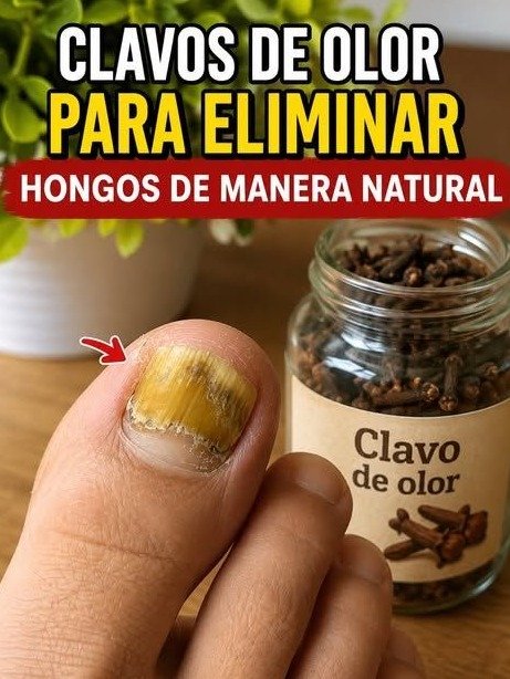 El Secreto Olvidado de la Abuela para Uñas Impecables: ¡Lo que NADIE te Cuenta sobre el Clavo de Olor!