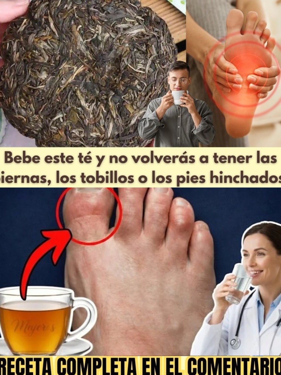 ¡Adiós Piernas Hinchadas! El ÚNICO Té Natural Que Necesitas Para Sentirte Ligera en Días (¡Receta Viral!)