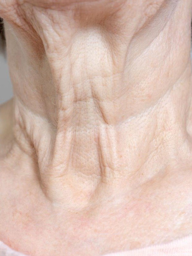 ¡Alerta en México! El Secreto del Laurel para las Arrugas del Cuello que NADIE te cuenta (y el error viral que te envejece)