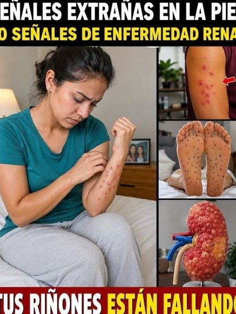 ¡ATENCIÓN! Tu Piel TE ESTÁ GRITANDO: 10 Señales URGENTES que Podrían Indicar Problemas en Tus Riñones (La #10 Te Dejará Sin Palabras)
