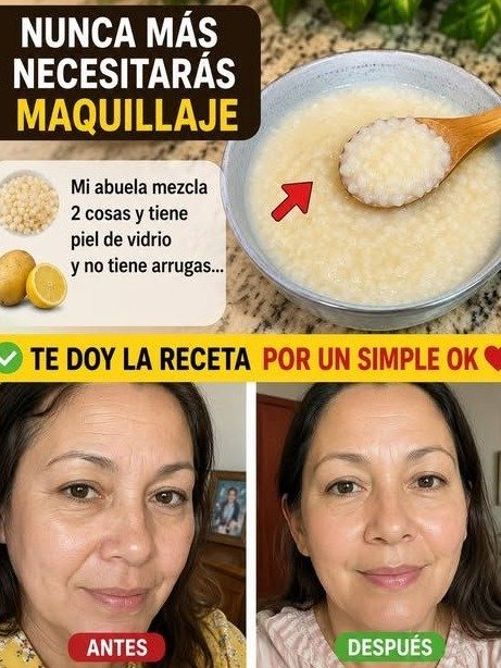 ¡ALERTA! Tu Mezcla Casera de Papa y Limón Podría Estar DAÑANDO tu Piel (El Error #1 que NADIE te dice y cómo EVITARLO)
