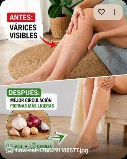 ¡BASTA de Piernas Pesadas y Venas Visibles! Descubre el Secreto de 2 Ingredientes de Cocina que Nadie Te Ha Contado (y 7 Hábitos para un Alivio REAL)