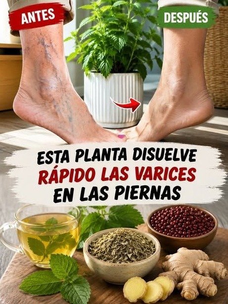 ¡Alerta Roja! ¿Piernas Pesadas y Venas Visibles? El ÚNICO Hábito que DEBES CAMBIAR HOY (y las 3 hierbas que los mexicanos ocultan)