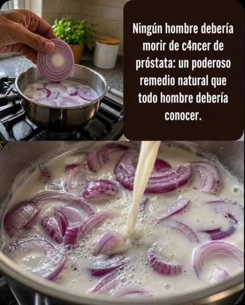 ¡El Secreto Casero que NINGÚN Hombre Debería Ignorar! ¿Cebolla y Leche para una Próstata de Acero?