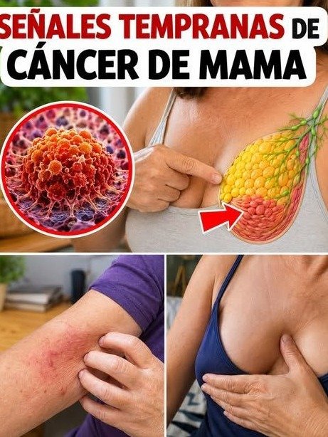 ¡Alerta Máxima! 10 Señales SILENCIOSAS del Cáncer de Mama que Muchas Ignoran (y NO TE PUEDES PERDER el Hábito Clave)