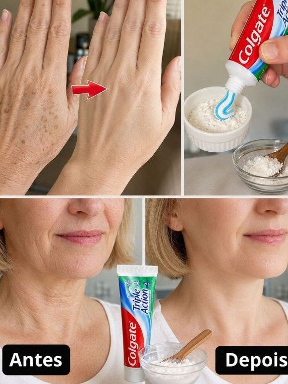 ¡Imposible! La Receta Casera que Hizo que Todos Pregunten si me Operé Manos y Brazos (El Secreto Viral que Debes Saber)