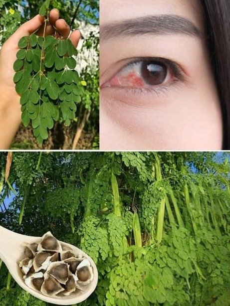 ¡IMPRESIONANTE! 🌿 El 'Árbol Milagroso' Moringa Revela 16 Secretos para una Salud Vibrante (¡No te lo Pierdas!)