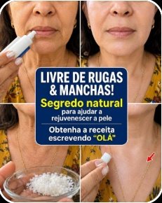 ¡Parece Que Me Hice Cirugía! El Secreto Casero que Borra Arrugas y Manchas de Manos y Brazos en Semanas (¡No te lo Pierdas!)