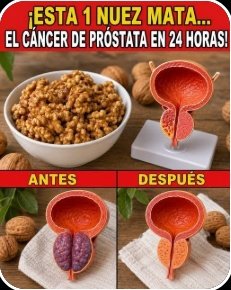 ¡El secreto que tu próstata te ruega saber! Un cambio sencillo en tu dieta puede transformar tu vida (y evitar visitas incómodas)