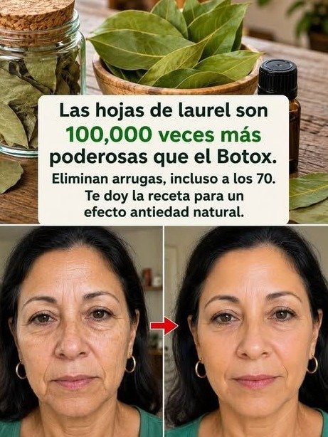 ¡Ni Botox, Ni Cremas Caras! El Increíble Secreto de la Hoja de Laurel que Está Rejuveneciendo Rostros y Borrando Arrugas SIN Salir de Casa