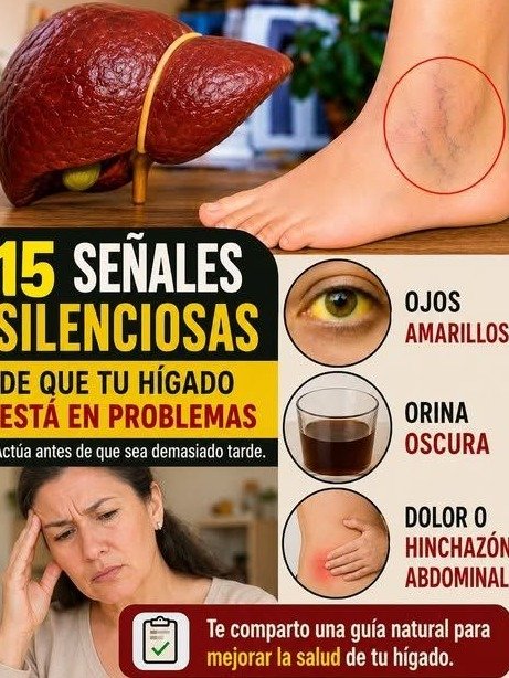 ¡Tu Hígado Grita Auxilio! 5 Señales CLAVE del Hígado Graso Que Debes Conocer YA (Antes de Que Sea Tarde)