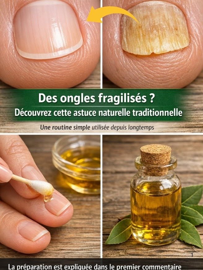 ¡Adiós Hongos en las Uñas! El Secreto Ancestral del Laurel que NADIE te ha Contado (y cómo usarlo HOY)