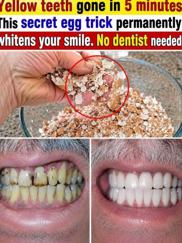 Stop Throwing Them Away! Why Eggshell Powder Is the Secret to a Bright, Stain-Free Smile