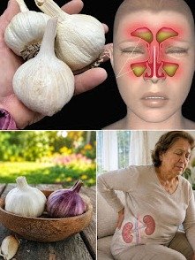 ¡Deja de sufrir! El truco ancestral con ajo que tus senos paranasales y riñones agradecerán (y es natural)