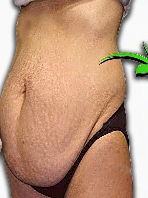 Don't Miss Out: The 4-Ingredient Morning Elixir That Will Revolutionize Your Weight Loss & Metabolism!