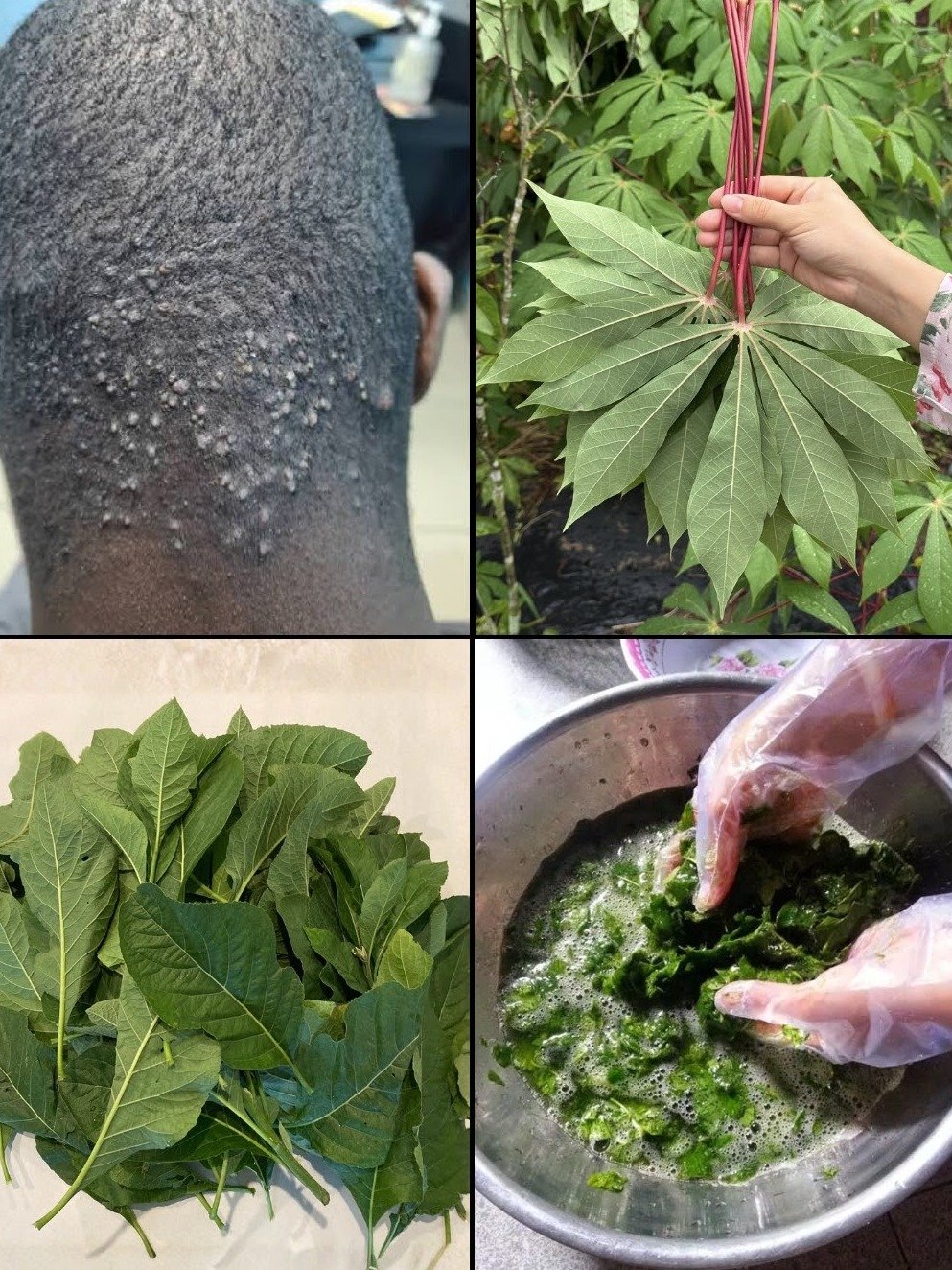 Stop Ignoring Those Painful Bumps on Your Head: Try This Simple Herbal Fix Today!