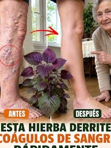 ¡DESVELADO! El Secreto que Tu Cardiólogo NO Quiere que Sepas: Las 6 Infusiones 'PROHIBIDAS' que Desatascan Arterias y te Dan un Corazón de Acero en SOLO 21 Días
