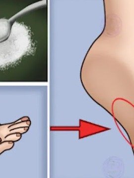 9 Subtle Signs You’re Eating Too Much Sugar (And How to Fix It Without Giving Up Everything)