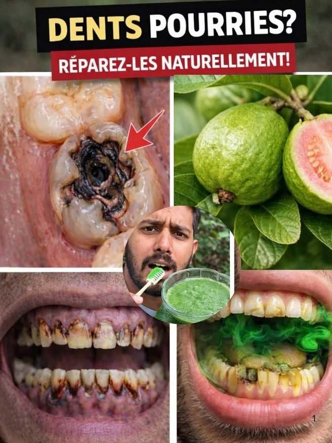 ¡Alerta! Tu Boca Te Lo Agradecerá: 3 Trucos con Hojas de Guayaba que tu Dentista NO te ha Contado (y adiós caries)