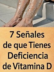 ¡Alerta! Tu Cuerpo Te Grita: 7 Señales INESPERADAS de que te Falta Vitamina D (¡No ignores la #5!)