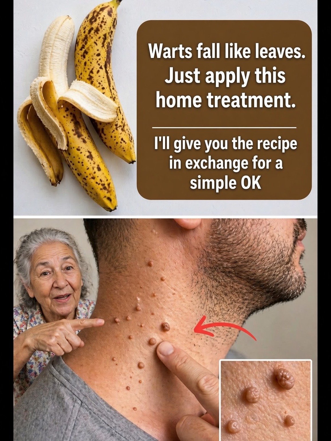 Stop Using Banana Peels on Your Warts! Here’s Why Viral Home Remedies Might Be Hurting You