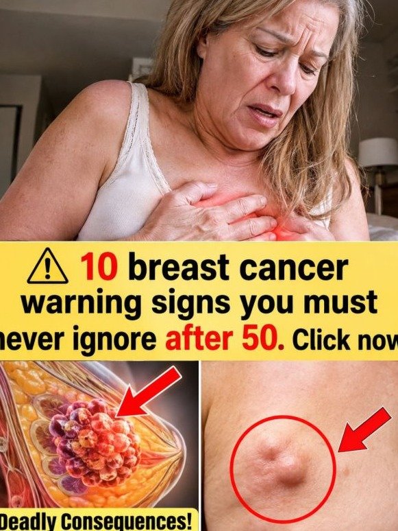 10 Subtle Breast Cancer Warning Signs Women Over 50 Often Mistake for 'Aging'