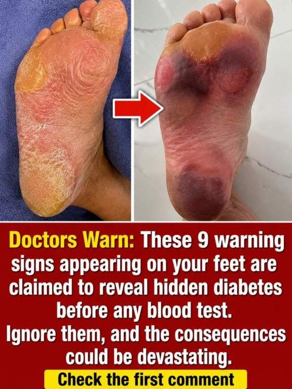 Your Feet Are Sending Warning Signals Long Before Your Blood Test Results Do