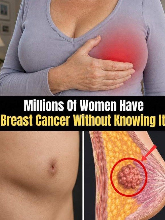 ¡No Es Solo un Bulto! 12 Señales SILENCIOSAS de Cáncer de Mama Que TODA Mujer Debe Conocer (Y Por Qué Son Vitales)