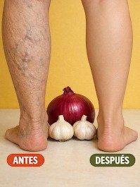 El Secreto de tu Cocina que Elimina Varices y Transforma tus Piernas en Días: ¡No te lo Pierdas!